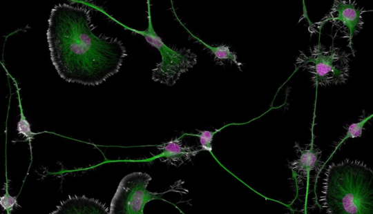 Imagen de células tumorales diferenciadas de cerebro de ratón
